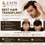 PRP Hair Treatment in Pune: Understanding Platelet-Rich Plasma Therapy for Hair