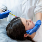 GFC Treatment in Jayanagar: Benefits, Procedure, Results & Recovery
