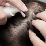 What Should You Avoid After GFC Hair Treatment in Dubai? 3 What Should You Avoid After GFC Hair Treatment in Dubai?