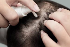 What Should You Avoid After GFC Hair Treatment in Dubai? 1 What Should You Avoid After GFC Hair Treatment in Dubai?