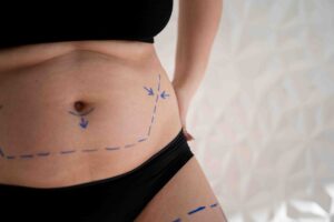 Why Your Body Shape Doesn’t Always Reflect Your Weight 1 Why Your Body Shape Doesn’t Always Reflect Your Weight