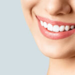 Yellow Teeth in Nashik? Common Causes and Teeth Whitening Options