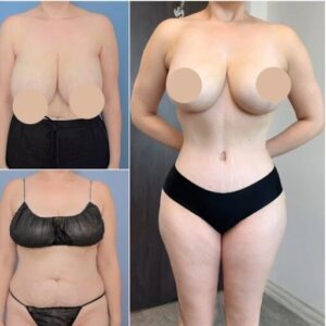 Best Doctors in Dubai for Tummy Tuck and Safe Cosmetic Excellence 1 Best Doctors in Dubai for Tummy Tuck and Safe Cosmetic Excellence