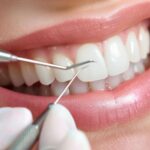 Teeth Cleaning in Bibwewadi: Why Routine Dental Cleaning Shouldn’t Be Overlooked