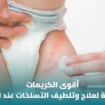 أفضل كريم لعلاج حساسية الحفاض: كيف تختار المناسب لطفلك؟ 3 أفضل كريم لعلاج حساسية الحفاض: كيف تختار المناسب لطفلك؟