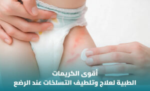 أفضل كريم لعلاج حساسية الحفاض: كيف تختار المناسب لطفلك؟ 1 أفضل كريم لعلاج حساسية الحفاض: كيف تختار المناسب لطفلك؟