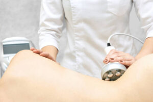 Exploring Venus Legacy for Facial Contouring and Skin Tightening 1 Exploring Venus Legacy for Facial Contouring and Skin Tightening