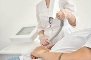Laser Tattoo Removal in Riyadh for Black Ink Tattoosd 1 Laser Tattoo Removal in Riyadh for Black Ink Tattoosd
