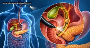 Choosing The Right Hospital For ERCP