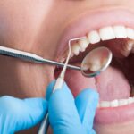Why Are My Teeth Sensitive? Common Causes and Treatment Options 5 Why Are My Teeth Sensitive? Common Causes and Treatment Options
