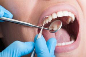 Why Are My Teeth Sensitive? Common Causes and Treatment Options