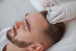 Hair Fall Problem? Know Your Treatment Options in Gurgaon 1 Hair Fall Problem? Know Your Treatment Options in Gurgaon