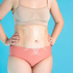 Tummy Tuck Surgery and the Importance of Maintaining Stable Weight