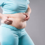 What Is Tummy Tuck Surgery in Riyadh and How Does It Work?
