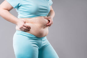 What Is Tummy Tuck Surgery in Riyadh and How Does It Work? 1 What Is Tummy Tuck Surgery in Riyadh and How Does It Work?