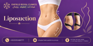 Does Liposuction Help Refine Body Contours? 1 Does Liposuction Help Refine Body Contours?