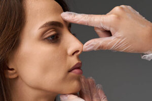 Rhinoplasty for Improving Facial Balance and Proportions