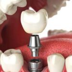 Why Regulation Determines Which Dental Labs Dentists Trust