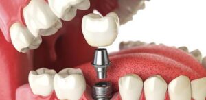 Why Regulation Determines Which Dental Labs Dentists Trust 1 Why Regulation Determines Which Dental Labs Dentists Trust