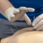 Dry Needling vs Acupuncture: Which Approach May Be Right for Your Pain? 3 Dry Needling vs Acupuncture: Which Approach May Be Right for Your Pain?