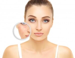 Can Facial Scar Revision in Islamabad Address Scars With Both Color and Texture Changes? 1 Can Facial Scar Revision in Islamabad Address Scars With Both Color and Texture Changes?