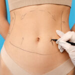 Fat Melting Injections in Riyadh 19