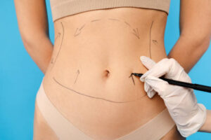 Fat Melting Injections in Riyadh vs. Traditional Fat Reduction Methods 1 Fat Melting Injections in Riyadh vs. Traditional Fat Reduction Methods