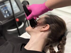 Where to Get RF Facial Contouring in Alberta: Treatment Options, Benefits & Booking Guide