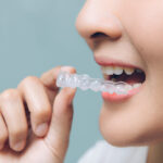 Can Mouth Guards Help Prevent Tooth Wear and Cracks? 3 Can Mouth Guards Help Prevent Tooth Wear and Cracks?