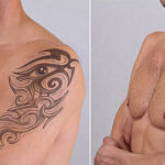 How Laser Tattoo Removal Targets Unwanted Tattoo Ink