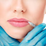 A Beginner’s Guide to Lip Filler Treatments