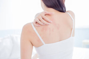 Skin Diseases: How to Recognize Changes in Texture, Color, and Appearance 1 Skin Diseases: How to Recognize Changes in Texture, Color, and Appearance