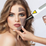 Q-Switched Laser for Brighter Skin and Improved Complexion