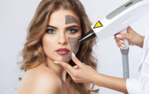 Q-Switched Laser for Brighter Skin and Improved Complexion 1 Q-Switched Laser for Brighter Skin and Improved Complexion