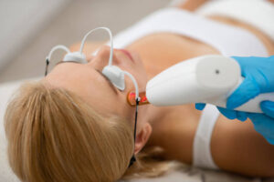 Understanding the Benefits of Q-switched Laser Treatment for Skin 1 Understanding the Benefits of Q-switched Laser Treatment for Skin
