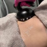 Which Body Contouring Treatment Is Best for You in Edmonton