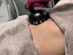 Which Body Contouring Treatment Is Best for You in Edmonton 1 Which Body Contouring Treatment Is Best for You in Edmonton