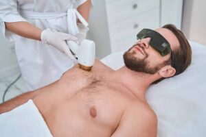 Laser Hair Removal for Men in Edmonton: Back, Chest, Beard and Neck Treatments 1 Laser Hair Removal for Men in Edmonton: Back, Chest, Beard and Neck Treatments