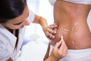 Why Mole Removal Kent Starts With A Proper Consultation And Not A Quick Fix