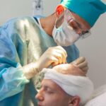 Thinking About a Hair Transplant? Here Is What You Should Know First