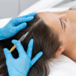 PRPHairTreatment in Riyadh 13