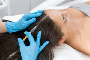 PRP Hair Treatment for Different Hair and Scalp Concerns