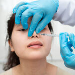What Is the Recovery Timeline After Rhinoplasty?