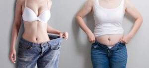 My Experience With Tummy Tuck Surgery: Understanding the Procedure 1 My Experience With Tummy Tuck Surgery: Understanding the Procedure
