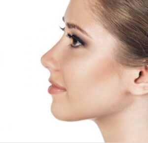 Can I Wear Glasses and Makeup After Rhinoplasty in Islamabad? 1 Can I Wear Glasses and Makeup After Rhinoplasty in Islamabad?