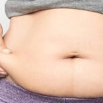 Who Is the Best Candidate for Liposuction in Islamabad? 3 Who Is the Best Candidate for Liposuction in Islamabad?