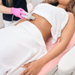 What to Expect During a Venus Legacy Treatment Session