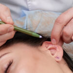 Ear Surgeryyy