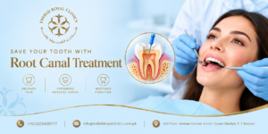 Is Root Canal Treatment Suitable for Back Teeth? 1 Is Root Canal Treatment Suitable for Back Teeth?