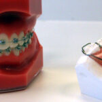 Can Dental Activators Help Guide Proper Teeth Development?